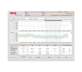 Screenshot of the seca diagnostic software displaying ambulatory blood pressure monitoring (ABPM) results with graphs for heart rate and blood pressure trends over time, along with detailed numerical data.